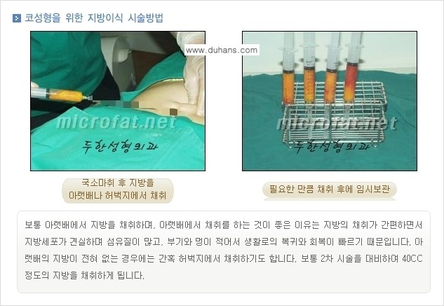 [두한성형외과 경쟁력 미세지방이식] - [미세지방이식을 이용한 코성형의 장점 안내] 관련 이미지 4