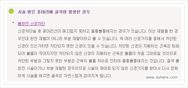 [두한성형외과 경쟁력 멀티종아리성형] - [굵은종아리, 알통종아리 수술 방법 안내] 관련 이미지 5