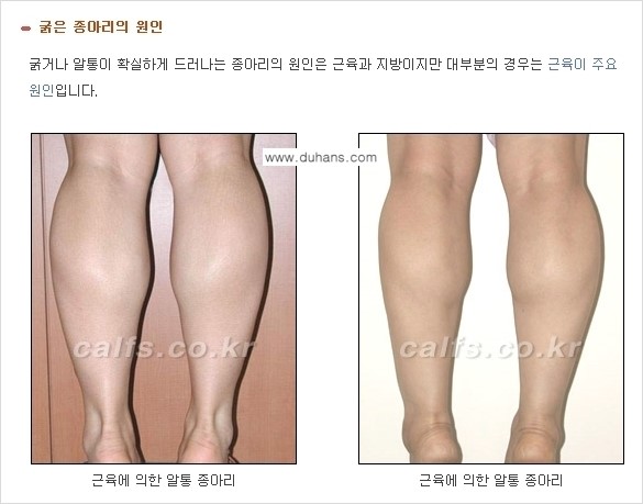 [두한성형외과 경쟁력 있는 종아리성형] - [초음파 유도 신경차단술 1.] 관련 이미지 7