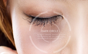 [Duhan Plastic Surgery Dark Circles] - [Under-Eye Dark Circle 5-Step Solution] image 7