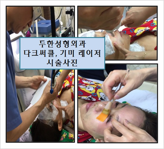 Duhan Plastic Surgery Laser Treatment - Mole Removal, Spot Removal, Melasma, Blemishes, Hyperpigmentation, Skin Tone Improvement, Elasticity Improvement, Skin Texture Improvement image 38