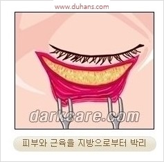 [두한성형외과 경쟁력 안검성형] - [젊어 보이면서 개선된 인상을 주기 위한 성형] 관련 이미지 5
