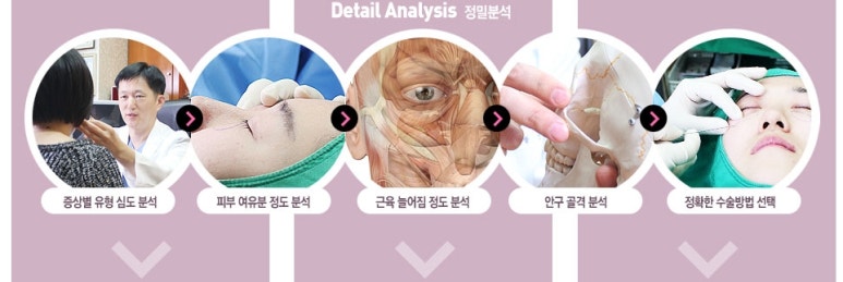 두한성형외과 눈밑수술 - 다크서클 수술 전후 관리 안내 관련 이미지 112