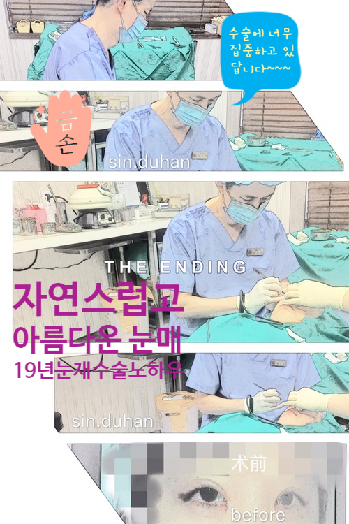 [두한성형외과 쌍꺼풀재수술] - [비대칭쌍꺼풀, 비대칭눈] 관련 이미지 23