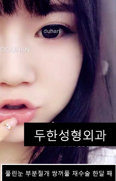 [Duhan Plastic Surgery] - [Revision Surgery for Relaxed Double Eyelids] image 4