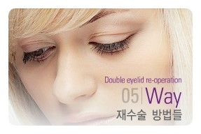 [두한성형외과 경쟁력 쌍꺼풀 재수술] - [완전절개법(Full incision method), 부분절개법(Partial incision method) 재수술] 관련 이미지 2