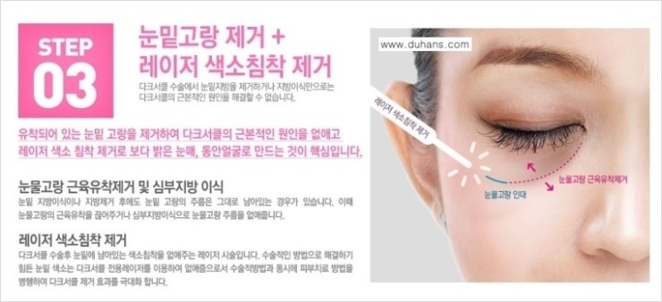 [두한성형외과 경쟁력 다크써클 치료] - [다크써클 5단계로 이뤄지는 핵심 5 STEP SOLUTION 안내 2.] 관련 이미지 2