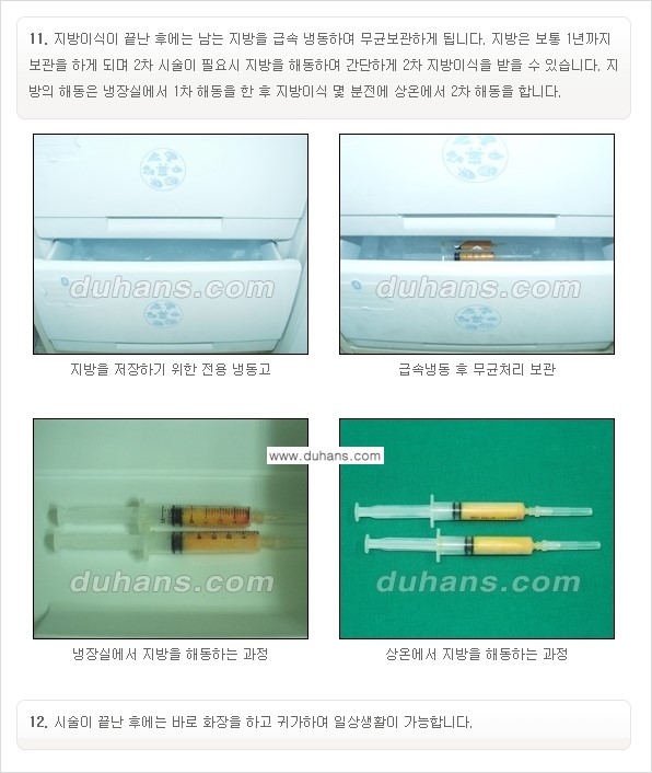 [두한성형외과 경쟁력 미세지방이식] - [부드럽고 아름다운 얼굴선 얼굴 미세지방이식 과정] 관련 이미지 11