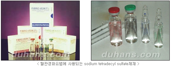 [두한성형외과 정맥류] - [하지정맥류, 정맥확장증, 혈관확장증] 관련 이미지 8