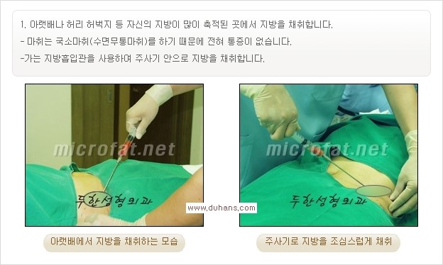 [두한성형외과 경쟁력 미세지방이식] - [타병원에서의 미세지방이식 이후 부작용 교정의 대상 안내] 관련 이미지 17