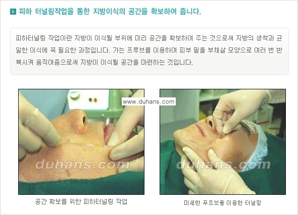 [두한성형외과 NO.1 지방이식]-[두한 지방이식 클리닉의 특징] 관련 이미지 10