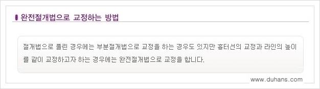 [두한성형외과 경쟁력 쌍꺼풀 재수술(극한 재수술)] - [라인이 풀렸을 경우의 쌍꺼풀 재수술 안내 ①] 관련 이미지 3