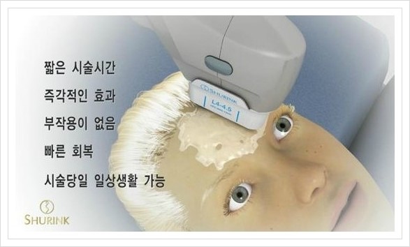 [두한성형외과 경쟁력 주름성형] - [HIFU 초음파 리프팅 주름교정술 안내 2.] 관련 이미지 7