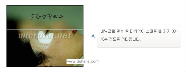 [두한성형외과 경쟁력 퀵성형] - [필러주사(쥬비덤)으로  간단하고 빠르게 주름교정] 관련 이미지 11