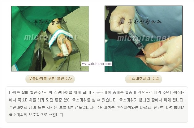 ​​[두한성형외과 경쟁력 지방흡입] - [아름다운 얼굴 윤곽선을 위한  볼살지방흡입, 턱선지방흡입 안내] 관련 이미지 5