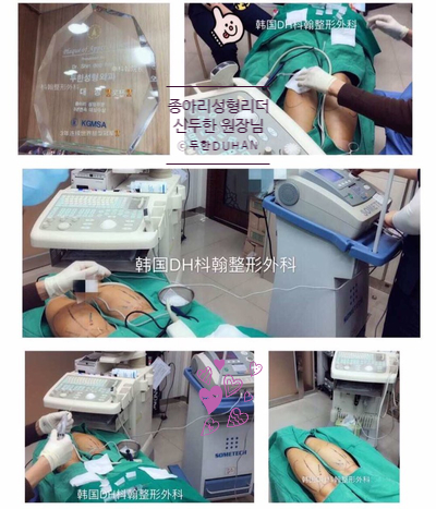 Duhan Plastic Surgery Calf Surgery - Precautions Before and After Calf Surgery image 62