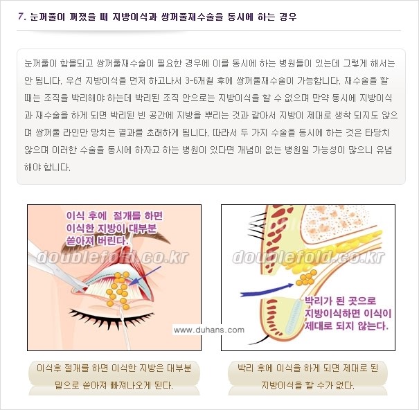 [두한성형외과 경쟁력 쌍꺼풀 재수술, 극한 눈재수술] - [쌍꺼풀 재수술, 눈 재수술의 실패 원인] 관련 이미지 7