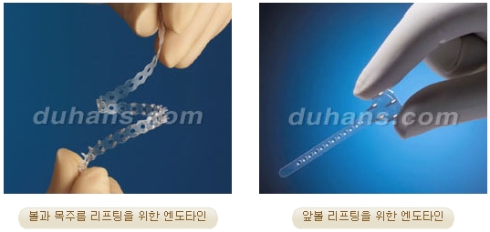 [두한성형외과 주름개선] - [주름교정 방법] 관련 이미지 12
