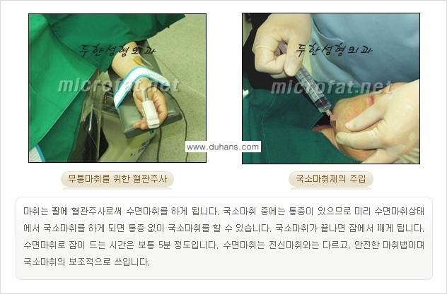 [두한성형외과 경쟁력 지방흡입] - [얼굴 지방흡입 부작용 교정방법 안내] 관련 이미지 8