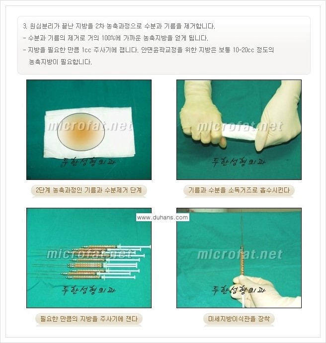 [두한성형외과 경쟁력 지방이식] - [지방이식 부작용 교정 안내 2.] 관련 이미지 7