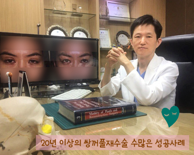 [Duhan Plastic Surgery Eyelid Surgery] - [Epicanthoplasty, Medial Canthoplasty] image 26