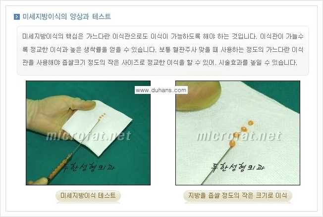 [두한성형외과 경쟁력 미세지방이식] - [3차원 입체 미세지방이식 안내] 관련 이미지 5