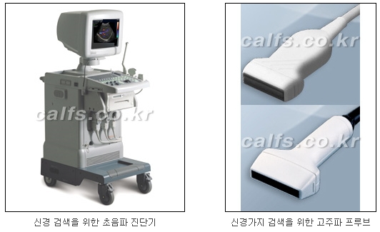 [두한성형외과 종아리퇴축술] - [NO절개! 초음파유도신경차단술] 관련 이미지 4