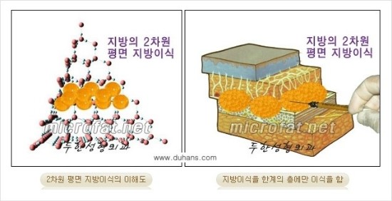 [두한성형외과 경쟁력 윤곽성형] - [3차원 미세지방이식을 이용한 이마성형, 인디언밴드 교정] 관련 이미지 2