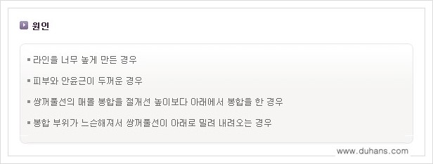 [두한성형외과 경쟁력 쌍꺼풀 재수술] - [절개선 아래가 두툼한 소세지 쌍꺼풀 안내] 관련 이미지 2