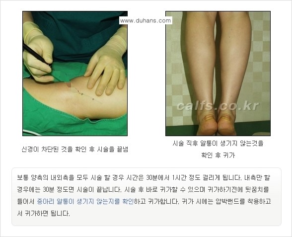 [두한성형외과 경쟁력 종아리성형] - [초음파 유도 선택적 신경차단술 안내 ②] 관련 이미지 12