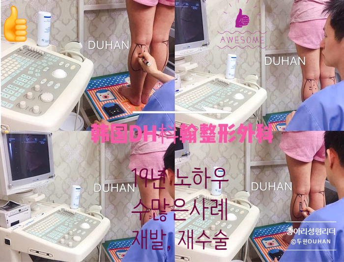[두한성형외과 종아리성형] - [초음파 유도 선택적 신경차단술] 관련 이미지 37