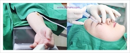 [두한성형외과 경쟁력 눈밑성형] - [하안검성형(눈밑주름제거술)에 의한 다크써클 교정] 관련 이미지 3