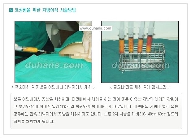[두한성형외과 경쟁력 미세지방이식] - [코 미세지방이식 안내] 관련 이미지 5
