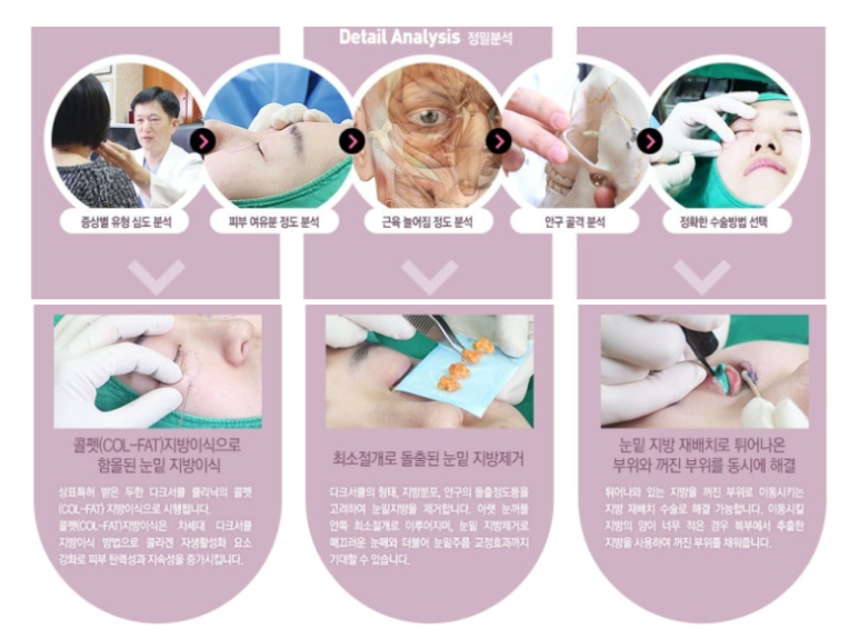 눈밑 다크써클 개선 원리 관련 이미지 16