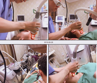 [Duhan Plastic Surgery Wrinkle Surgery] - [Endotine Lifting for Wrinkle Improvement] image 37
