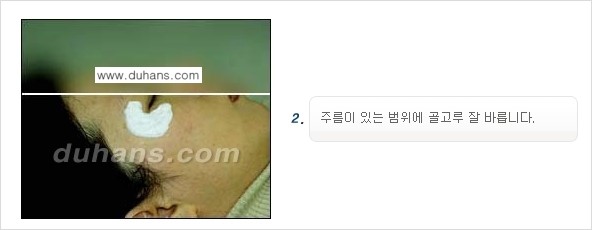 [두한성형외과 젊어지는 주름교정술] - [주름제거 시술방법 ④] 관련 이미지 5