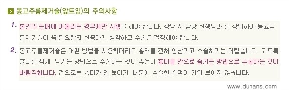 [두한성형외과 NO.1 눈성형] - [몽고주름 제거(앞트임 수술) 2.] 관련 이미지 12
