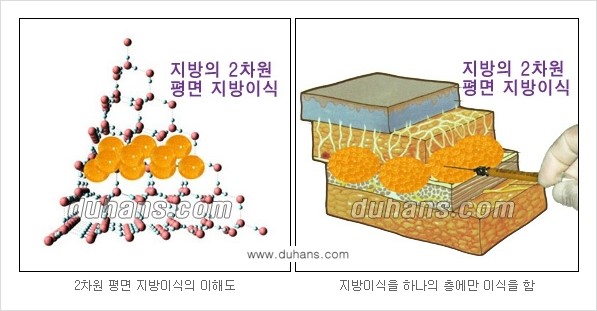 ⁠⁠[두한성형외과 경쟁력 미세지방이식] - [3차원 입체지방이식, 2차원 평면지방이식] 관련 이미지 3
