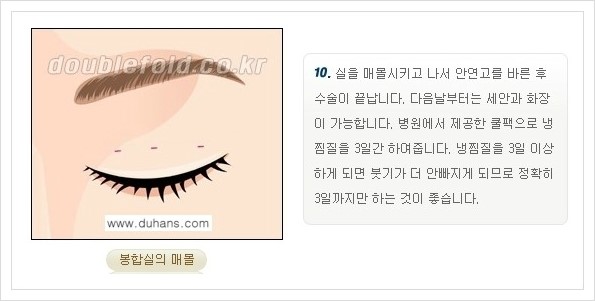 [두한성형외과 경쟁력 쌍꺼풀 재수술, 극한 재수술] - [쌍꺼풀 재수술의 과정 안내 1.] 관련 이미지 21