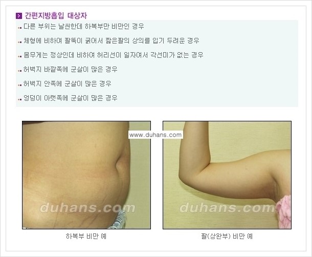 [두한성형외과 경쟁력 지방흡입] - [초음파 간편지방흡입 안내 ①] 관련 이미지 1