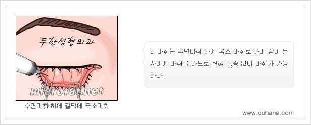 [두한성형외과 경쟁력 지방제거] - [눈밑(눈위)지방제거, 눈꺼풀(윗눈꺼풀)지방제거 안내 ①] 관련 이미지 6