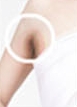 Duhan Plastic Surgery Laser Treatment - Mole Removal, Spot Removal, Melasma, Blemishes, Hyperpigmentation, Skin Tone Improvement, Elasticity Improvement, Skin Texture Improvement image 9