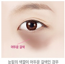 두한성형외과 눈밑수술 - 다크서클 수술 전후 관리 안내 관련 이미지 106