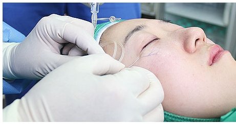 두한성형외과 보기싫은 혈관제거 - 눈밑혈관, 손과 팔의 혈관확장증 치료 관련 이미지 5
