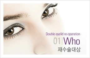[두한성형외과 경쟁력 눈성형] - [망가진 쌍꺼풀 라인을 정상적인 눈매로 복원하는 극한 재수술(Extreme Rroperation)] 관련 이미지 1