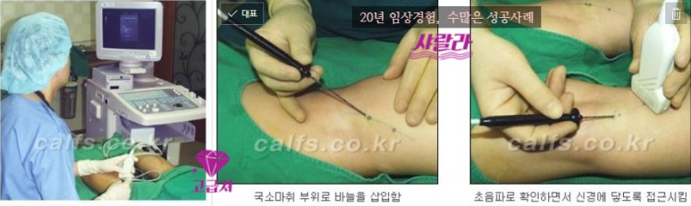 [종아리성형 두한성형외과] - [종아리수술에 대한 자주하는 질문과 답변 모음] 관련 이미지 82