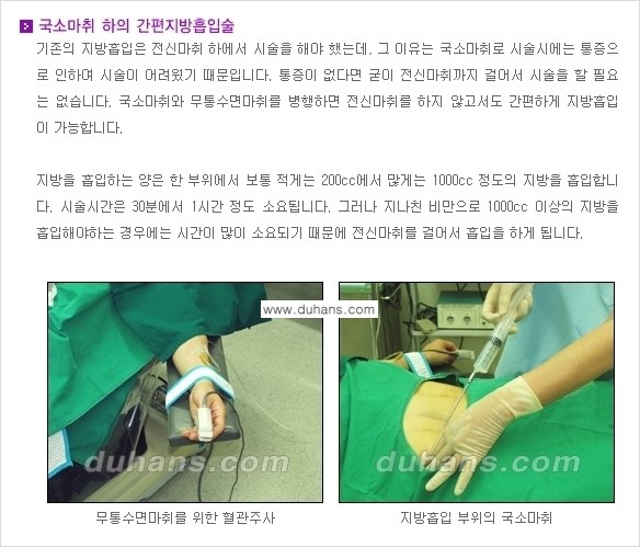 [두한성형외과 경쟁력 간편지방흡입] - [복부(뱃살) 비만 간편지방흡입] 관련 이미지 4