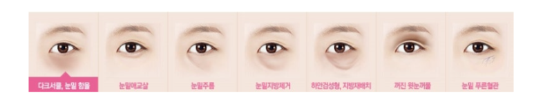 눈밑 다크써클 개선 원리 관련 이미지 5