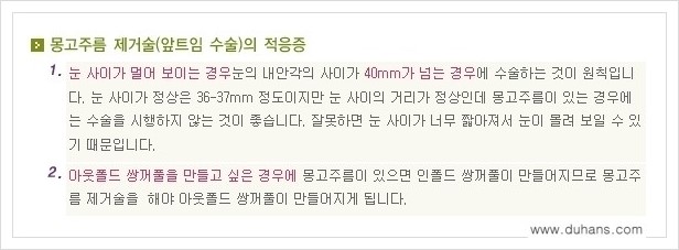 [두한성형외과 경쟁력 눈성형] - [앞트임 수술(몽고주름 제거) 안내 ①] 관련 이미지 5