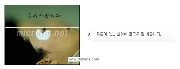 [두한성형외과 경쟁력 퀵성형] - [필러주사(쥬비덤)으로  간단하고 빠르게 주름교정] 관련 이미지 9
